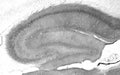 Adult rat hippocampus immunohistochemistry.