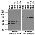 Immunoblot against crude membrane fractions from whole mouse (MBM) or rat (RBM) brain and from human hippocampus [HBM(H)], cerebral cortex [HBM(Cx)] or cerebellum [HBM(Cb)] and probed with K40/17 (left) or N52A/42 (right) TC supe.