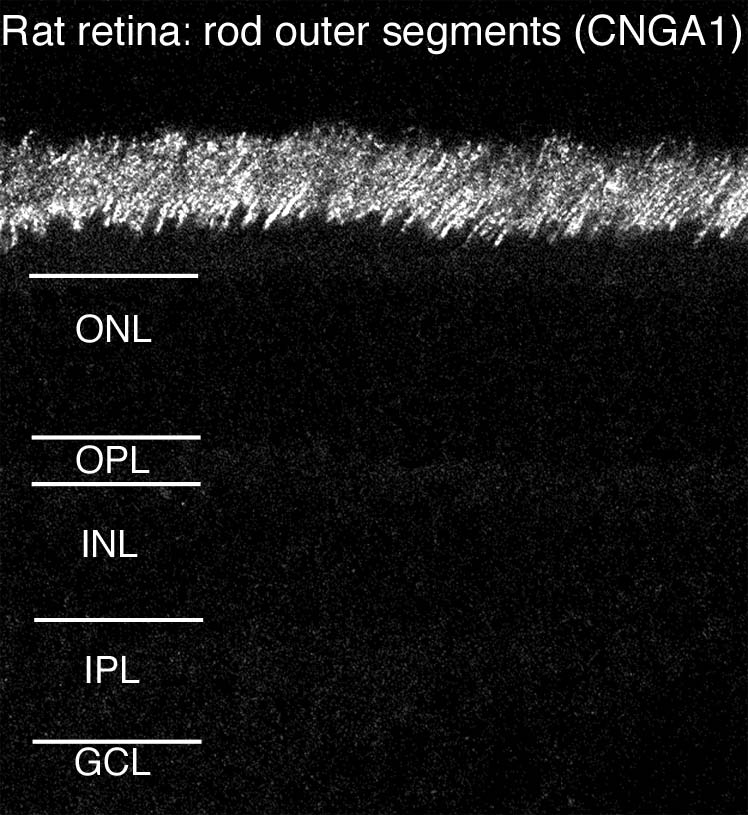 Isolated goldfish cone immunohistochemistry. Data courtesy of Diane Henry-Vanisko and Gary Matthews.