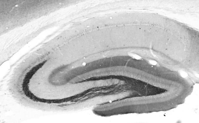 Adult rat hippocampus immunohistochemistry.