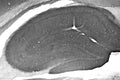 Adult rat hippocampus immunohistochemistry.