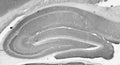 Adult rat hippocampus immunohistochemistry.