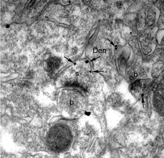 Electron micrograph shows N75/33 immunolabelling in the stratum radiatum of mouse hippocampal CA1 using a pre-embedding immunogold method. Immunogold particles were observed at postsynaptic sites (arrows) along the extrasynaptic plasma membrane of dendritic spines (s) and shafts (Den) of pyramidal cells establishing synaptic contacts with excitatory axon terminals (b). 80.000 X. Courtesy Dr. Rafael Lujan (Universidad de Castilla-La Mancha).