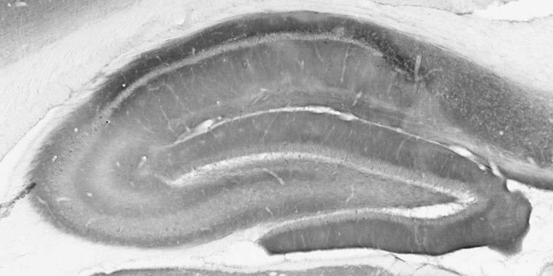 Adult rat hippocampus immunohistochemistry.