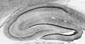 Adult rat hippocampus immunohistochemistry.