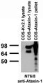 Transfected cell immunoblot: COS cells transiently transfected with Ataxin-1 and Kv2.1 plasmids and probed with N76/8 TC supe.