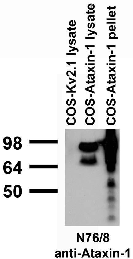 Transfected cell immunoblot: COS cells transiently transfected with Ataxin-1 and Kv2.1 plasmids and probed with N76/8 TC supe.