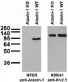 Adult rat brain immunoblot: extracts of cerebella from Ataxin-1 KO and WT mice and probed with N76/8 (left) or K89/41 (right) TC supe.
