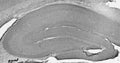 Adult rat hippocampus immunohistochemistry.