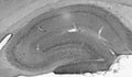 Adult rat hippocampus immunohistochemistry.