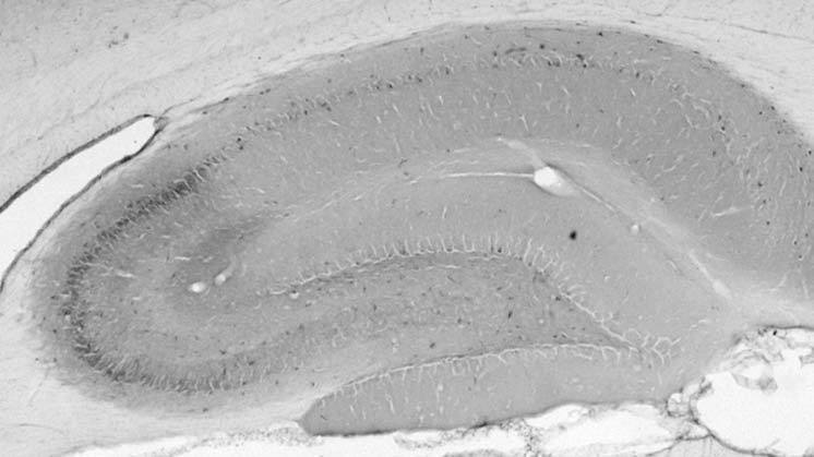 Adult rat hippocampus immunohistochemistry.