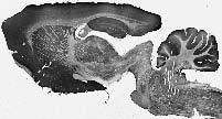Adult rat brain immunohistochemistry.