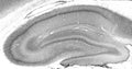 Adult rat hippocampus immunohistochemistry.