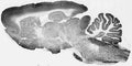 Adult rat brain immunohistochemistry (with antigen retrieval via pepsin pretreatment).