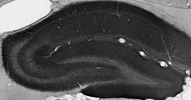 Adult rat hippocampus immunohistochemistry.
