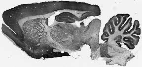 Adult rat brain immunohistochemistry.