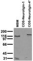 Adult mouse brain membrane (MBM) and transfected cell immunoblot: extracts of MBM and COS cells transiently transfected with Neuroligin-1 and Neuroligin-4* plasmids and probed with N98/7. Data courtesy of Marc Bolliger and Tom Sudhof, UTSW (now at Stanford).