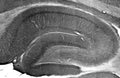 Adult rat hippocampus immunohistochemistry.