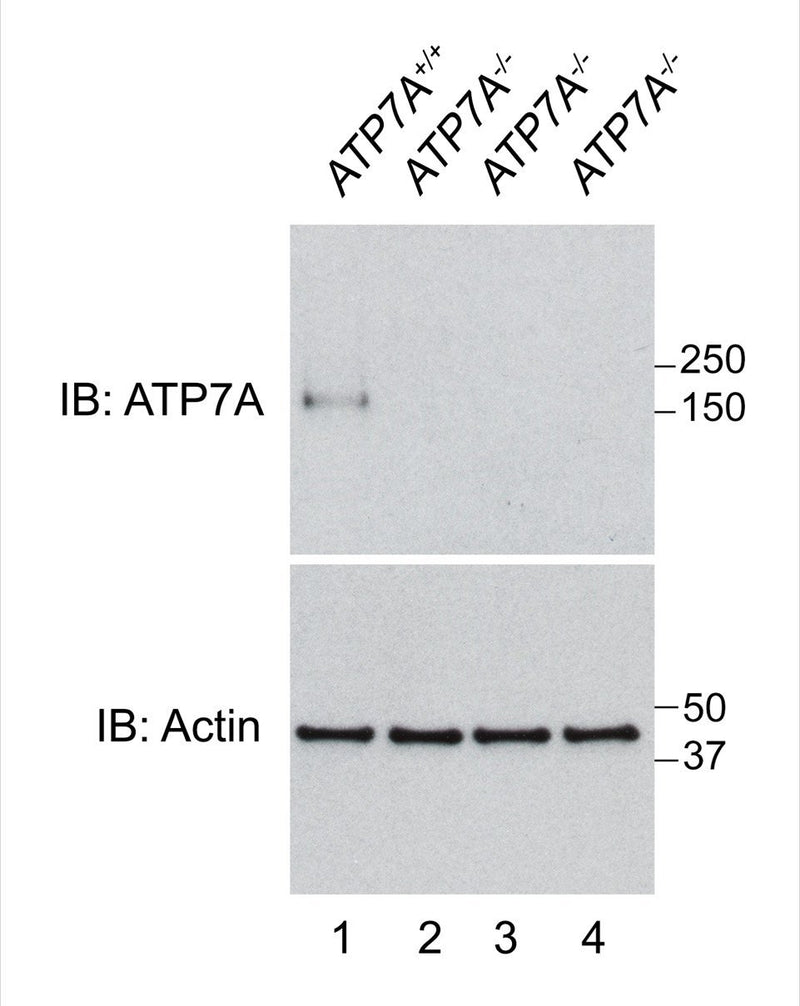 Immunoblot of lysates from human skin fibroblasts from an ATP7A wild-type individual (ATP7A+/+, Lane 1) and three individuals with ATP7A null mutations (ATP7A-/-, Lanes 2-4) probed with L60/4 (top) and actin (bottom). Data courtesy of Stephanie Zlatic and Victor Faundez (Emory University). See reference 2017 Comstra et al., eLife (PMID 28355134) for further detail.