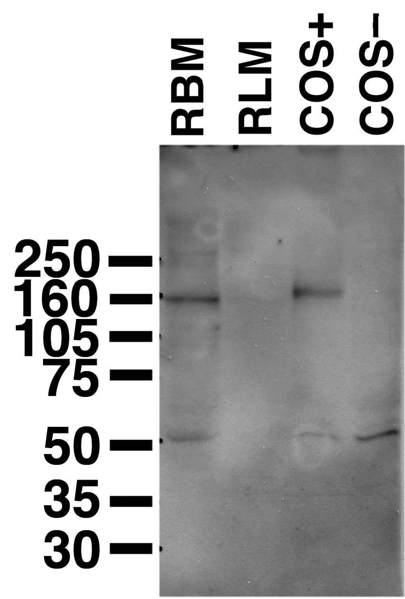 Immunoblot versus rat brain membranes (RBM), rat liver membranes (RLM) and lysates of COS-1 cells transfected with human Copper- transporting ATPase 2 (COS+) or empty vector (COS-) and probed with L62/29 tissue culture supernatant.