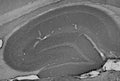 Adult rat hippocampus immunohistochemistry.