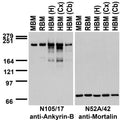 Immunoblot against crude membranes from whole mouse (MBM) or rat (RBM) brain and from human hippocampus [HBM(H)], cerebral cortex [HBM(Cx)] or cerebellum [HBM(Cb)] probed with N105/17 (left) or N52A/42 (right) TC supe.