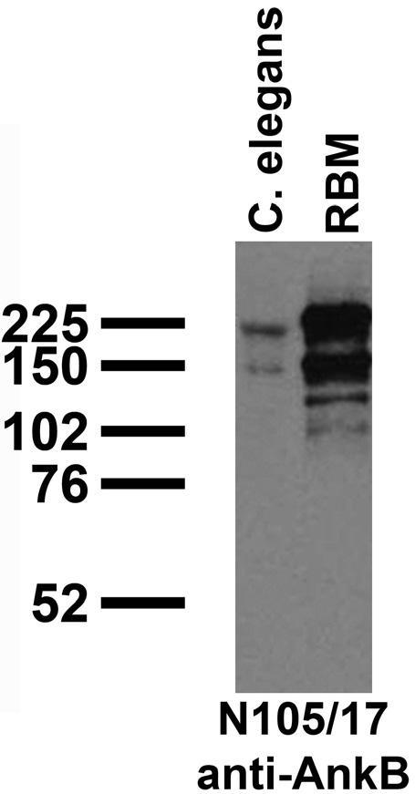 Immunoblot against crude C. elegans worm extracts and membranes from adult rat brain (RBM) probed with N105/17 TC supe.