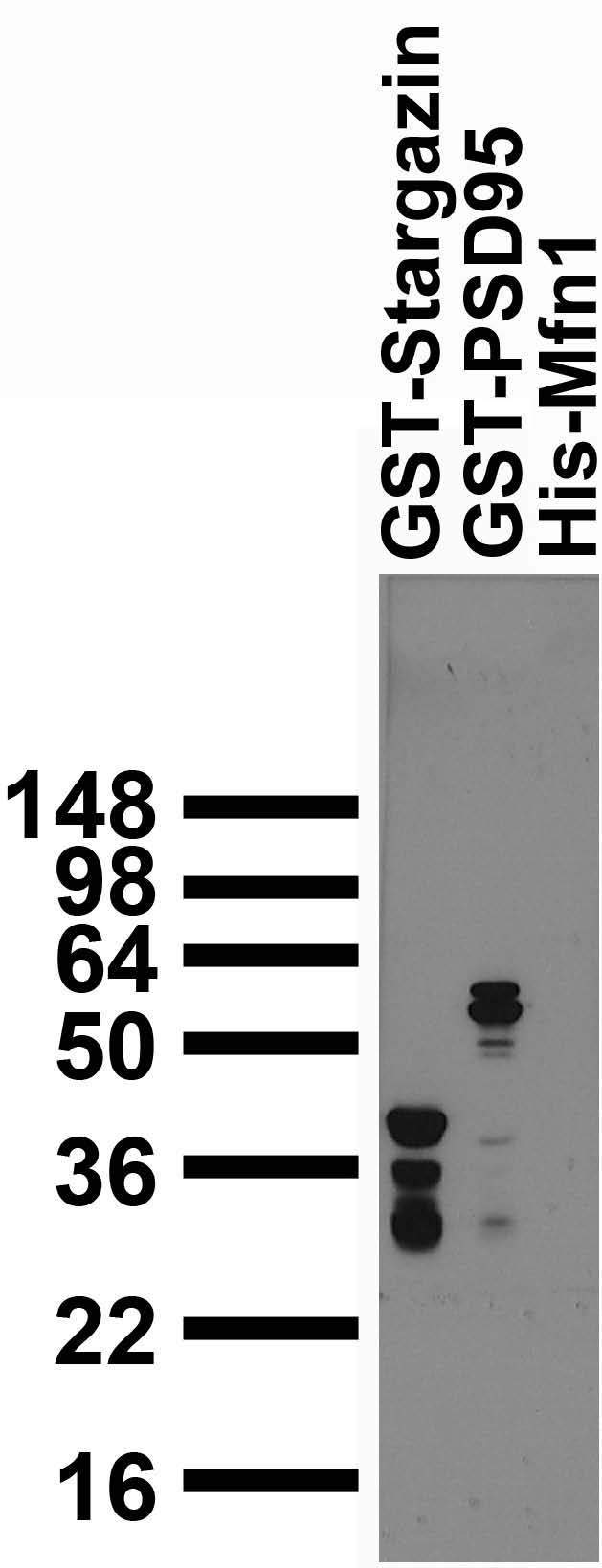 Bacterially expressed GST fusion protein immunoblot.