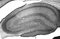 Adult rat hippocampus immunohistochemistry.