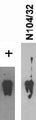 Neuronal immunoblot: lysates from neocortical neurons cultured under amino acid starvation and probed with rabbit polyclonal anti-SNAT1 (left) and N104/32 (right). Data courtesy of Jeffery Erickson (LSUHSC).