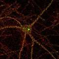 Cultured rat interneuron immunofluorescence staining. N127/31 (Pan-SAPAP) = green, rabbit anti-PSD-95 = red. Image courtesy of Dieter Edbauer and Morgan Sheng, Picower Institute.