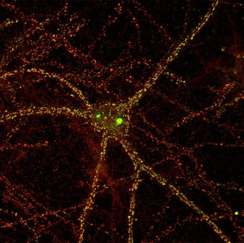Cultured rat interneuron immunofluorescence staining. N127/31 (Pan-SAPAP) = green, rabbit anti-PSD-95 = red. Image courtesy of Dieter Edbauer and Morgan Sheng, Picower Institute.
