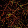 Cultured rat hippocampal pyramidal cell immunofluorescence staining. N127/31 (Pan-SAPAP) = green, rabbit anti-PSD-95 = red. 