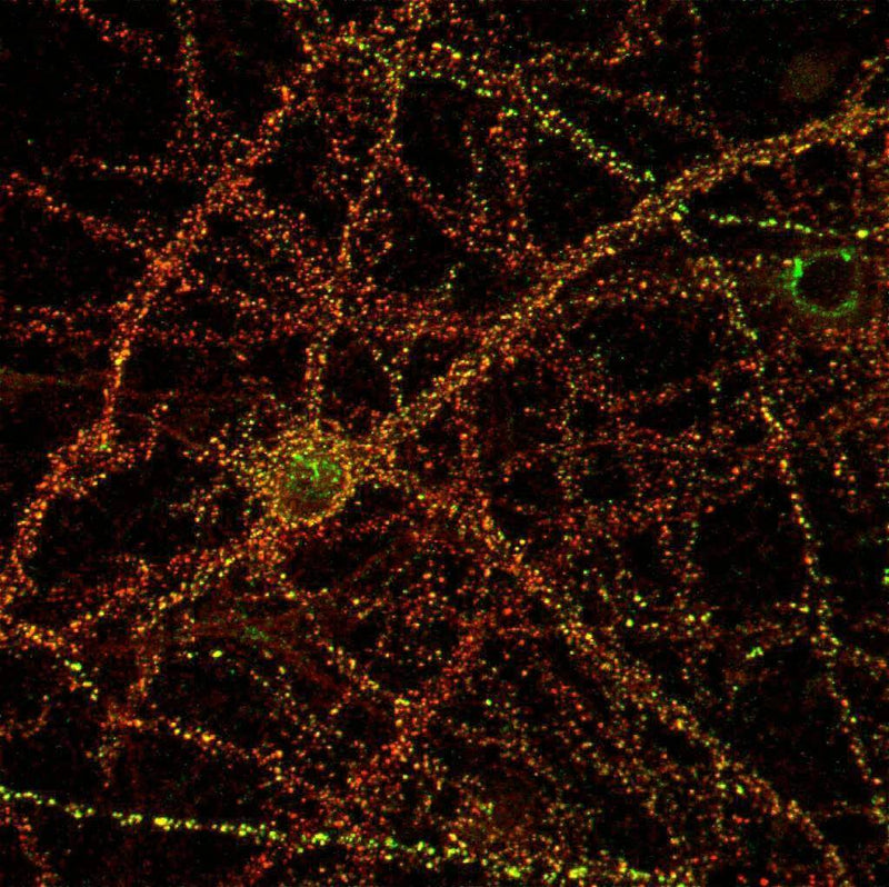 Cultured rat hippocampal pyramidal cell immunofluorescence staining. N127/31 (Pan-SAPAP) = green, rabbit anti-PSD-95 = red.  