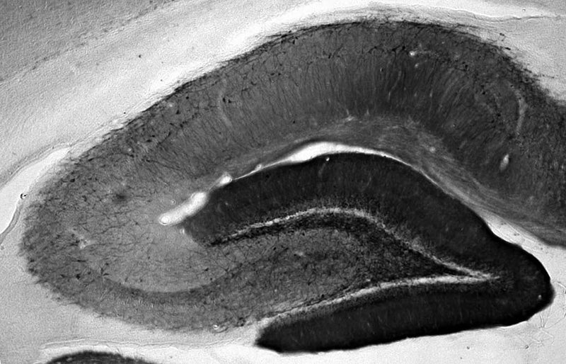 Adult rat hippocampus immunohistochemistry.