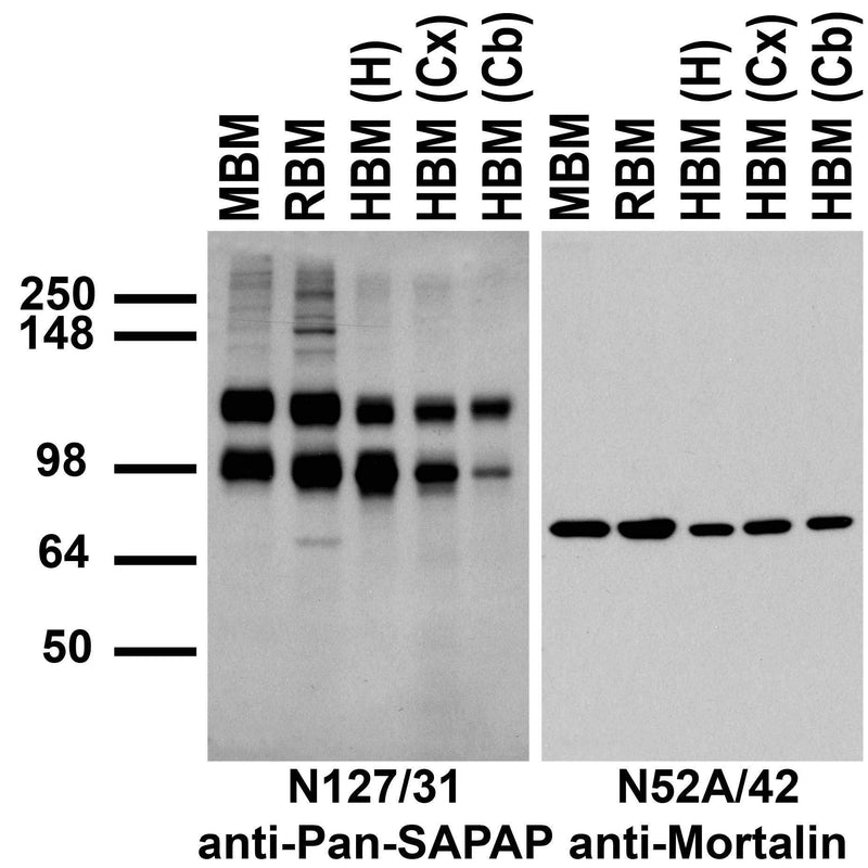 Immunoblots on membranes prepared from whole mouse (MBM) and rat (RBM) brain, and from human hippocampus [HBM(H)], cerebral cortex [HBM(Cx)], and cerebellum [HBM(Cb)].