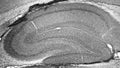 Adult rat hippocampus immunohistochemistry.