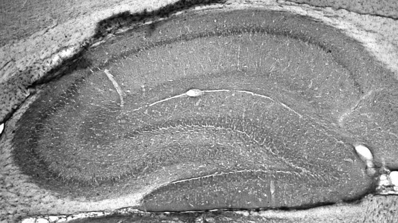 Adult rat hippocampus immunohistochemistry.
