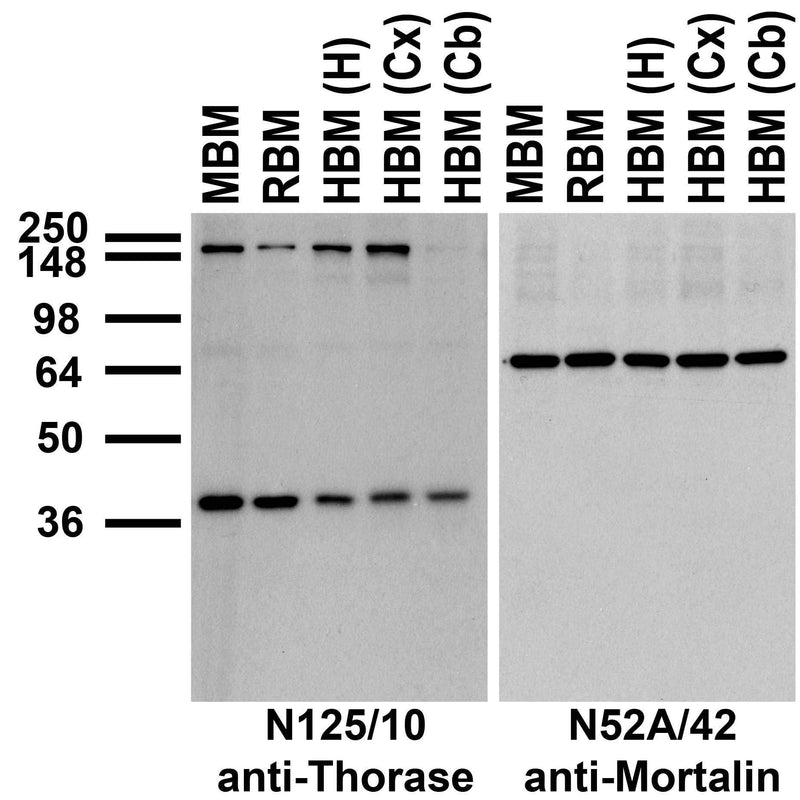 Immunoblots on membranes prepared from whole mouse (MBM) and rat (RBM) brain, and from human hippocampus [HBM(H)], cerebral cortex [HBM(Cx)], and cerebellum [HBM(Cb)].