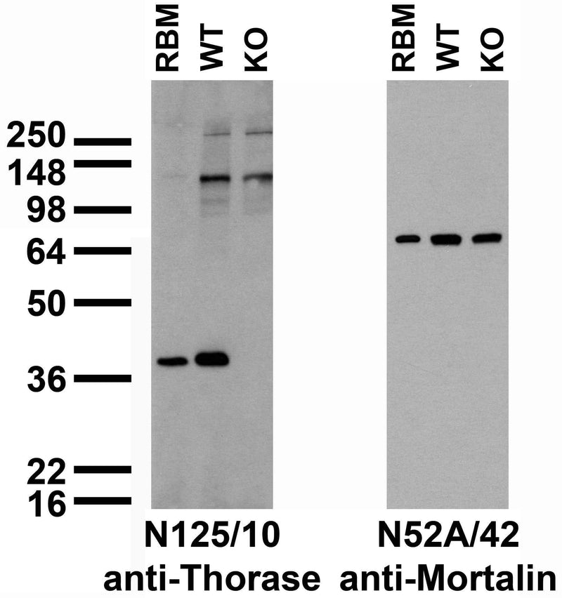 Immunoblots versus crude adult rat brain membranes (RBM) and brain extracts from Thorase WT and KO mice and probed with N125/10 (left) and N52A/42 (right) TC supe. Samples courtesy of Dr. Jianmin Zhang, Dr. Ted Dawson and Dr. Valina Dawson, Johns Hopkins School of Medicine.