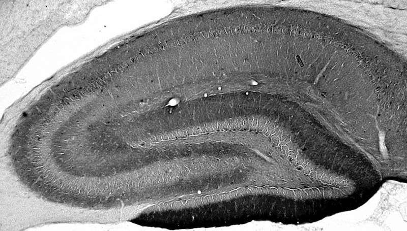 Adult rat hippocampus immunohistochemistry.
