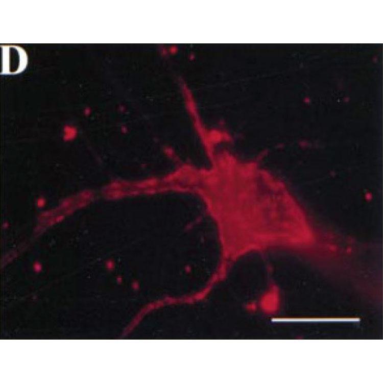 Surface immunofluorescence (no detergent permeabilization) of cultured rat hippocampal neuron transfected with HA-tagged Kv2.1 plasmid. Red = K39/25. Scale bar = 20 m. Reproduced from 2000 Lim et al Neuron (PMID 10719893).
