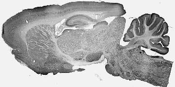 Adult rat brain immunohistochemistry.