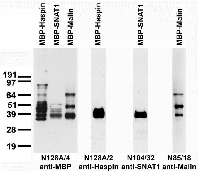 Bacterial fusion protein immunoblot.
