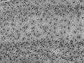 Adult rat hippocampus immunohistochemistry (high and low magnification).