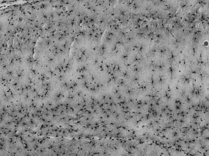 Adult rat hippocampus immunohistochemistry (high and low magnification).