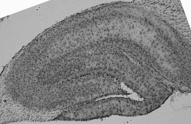 Adult rat hippocampus immunohistochemistry (high and low magnification).