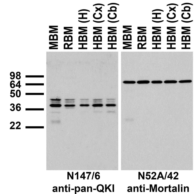 Immunoblots on membranes prepared from whole mouse (MBM) and rat (RBM) brain, and from human hippocampus [HBM(H)], cerebral cortex [HBM(Cx)], and cerebellum [HBM(Cb)].