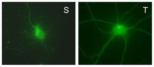 Cultured rat hippocampal neuron surface (S, left) and total (T, right) protein immunofluorescence staining (green) with N151/3 (2 mg/mL).