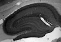 Adult rat hippocampus immunohistochemistry.